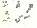 Russula recondita-amf1628-spores